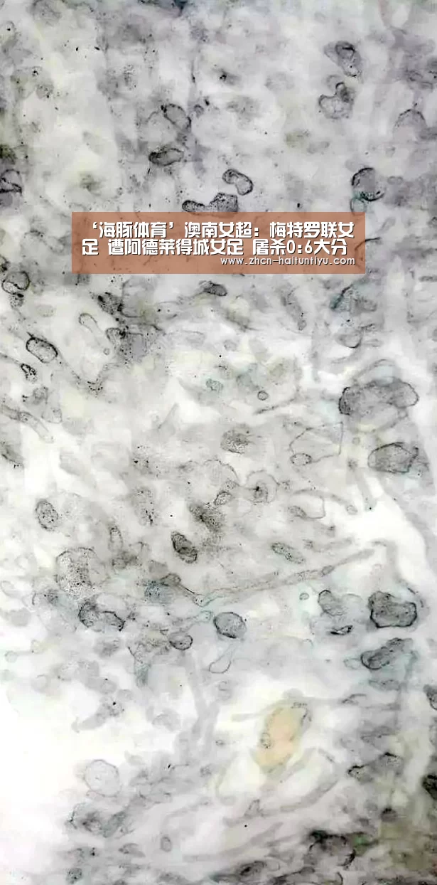 运动平台